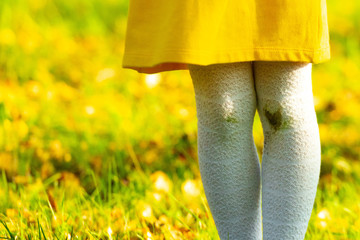 Dirty knees, baby. Little girl in a yellow dress and white stockings after falling to the ground....