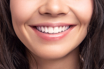 Closeup smile of young teen happy female woman great white teeth. Dental health.