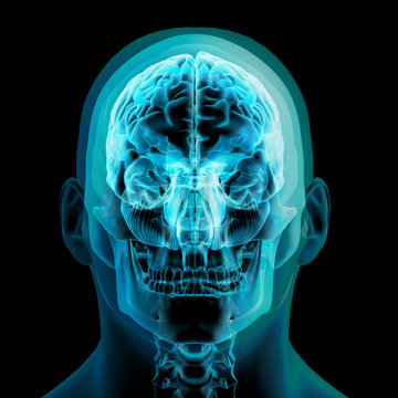 Front View of X-ray Head, Skull and Brain on Black