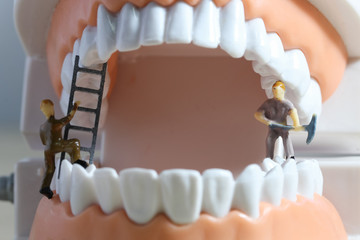 Miniature people or small figure worker cleaning tooth model as medical and healthcare concept....