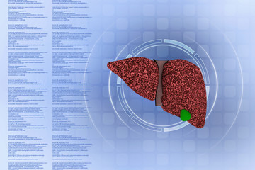 3d illustration Liver disease