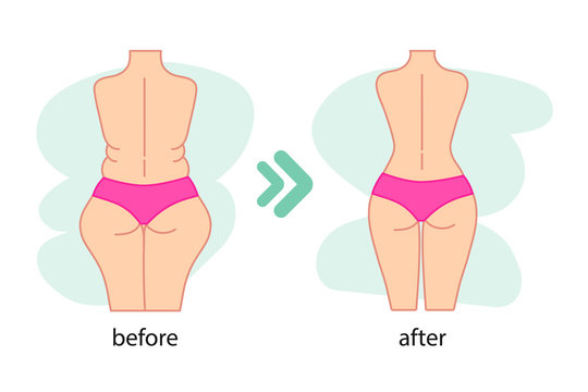 Fat and slim woman figure, before and after weight loss. Women's waist and buttocks weight loss, diet, waistline line icon. Vector illustration.