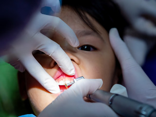 The dentist treats the child. Keeping baby teeth.