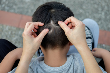 Mother is catching hair to find lice. - obrazy, fototapety, plakaty