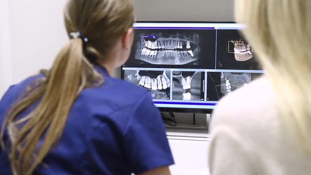 Female doctor shows the patient an x-ray image at display. Computer diagnostics dental tomography. Planning teeth treatment in modern dental clinic