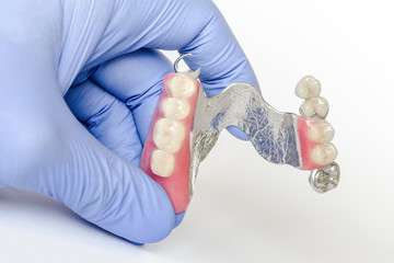 removable clasp prosthesis with clam fixation on the upper jaw in the hands of the dentist