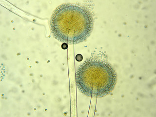 アスペルギルス　分生子