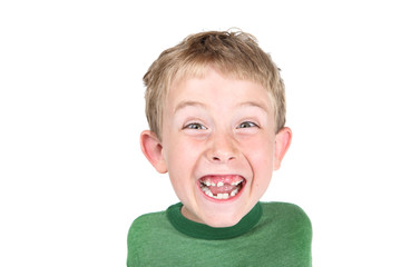 Young boy being silly showing his missing teeth