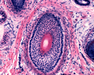 Human hair follicle