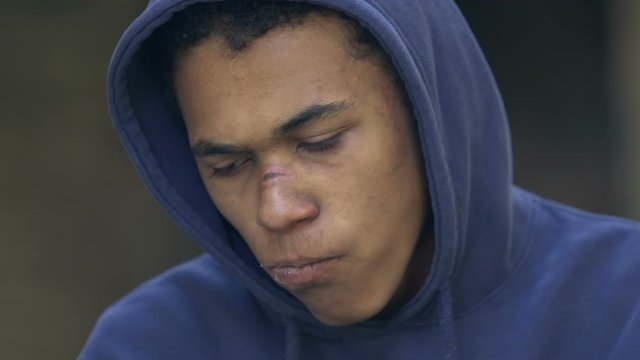 Sad african american teen with wounded face eating sandwich outdoor, bullying