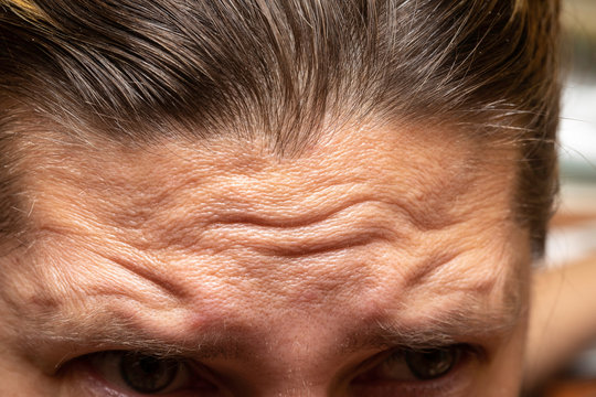forehead of mature caucasian man in close up view, face wrinkles concepts