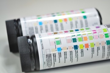 urine strip test