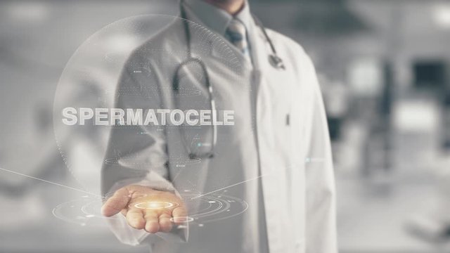 Doctor holding in hand Spermatocele