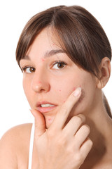 Fototapeta premium Young woman with acne problem on white background