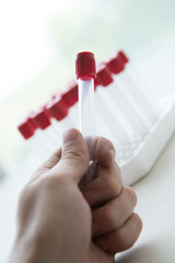 medical tubes for donated blood