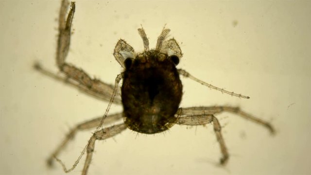  Young crab under a microscope, has already sunk to the bottom and will grow after each molt