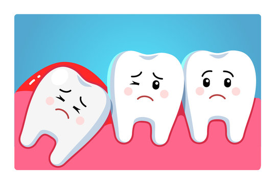 Wisdom tooth character, third molar tooth problem