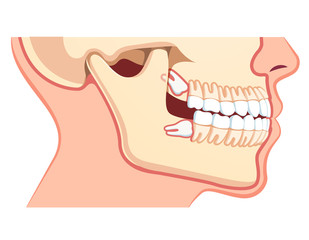 Human jaws model with teeth row. Dentistry