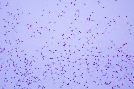 รูปภาพSeminal เลือกดูภาพถ่ายสต็อก เวกเตอร์ และวิดีโอ3,888 Adobe Stock