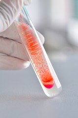 colony of bacteria in microbiology laboratory