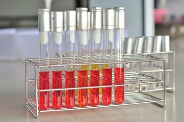 media in test tube with microbiology concept