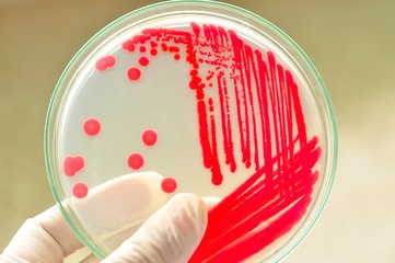 red colony of bacteria in microlaboratory