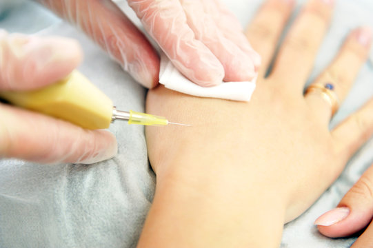 รูปภาพMicroinjection – เลือกดูภาพถ่ายสต็อก เวกเตอร์ และวิดีโอ154 ...