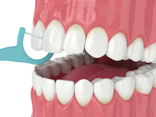 3d render of jaw with dental floss toothpick