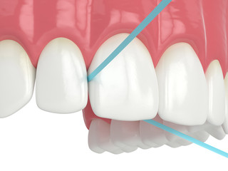 Fototapeta na wymiar 3d render of jaw with dental floss