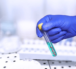 Bacteria test on laboratory test tube in the analyst's hand in a plastic glove