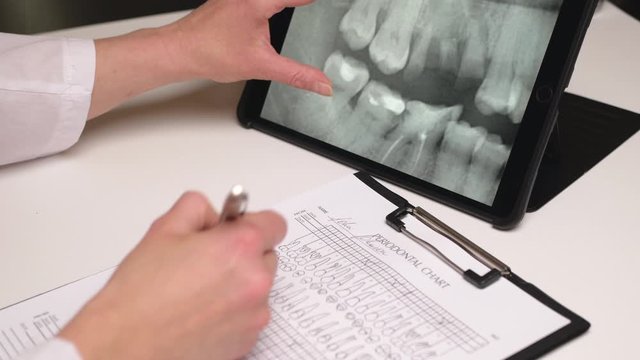 Female dentist looks at x-ray of teeth on a tablet and fills check form. Close up