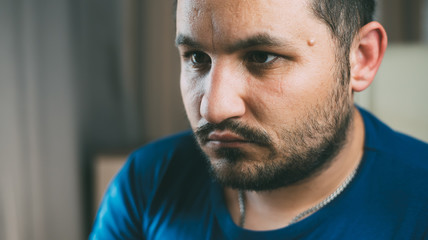 The tumor on the face of men near his temple , Lipoma Wen or zit, ugly acne, dermatology and ugliness