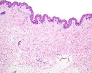 Thin skin. Hematoxylin-eosin
