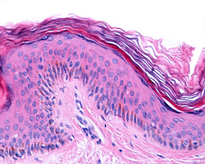 Melanocytes. Epidermis.