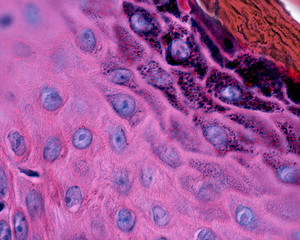 Epidermis. Spinous and granular layers