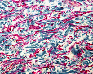 Dermis. Collagen and elastic fibers. Cajal-Gallego trichrome