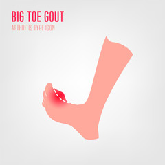 Gout arthritis icon