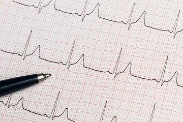 Electrocardiograma papel informe junto a un bolígrafo. Vista superior. Concepto: Salud Medicina