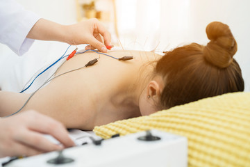 doctor or Acupuncturist applying electroacupuncture on patient's body. Shot of woman undergoing acupuncture treatment with electrical stimulator. meridian line. Traditional Chinese Medicine Concept - obrazy, fototapety, plakaty