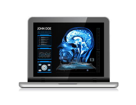 Notebook monitor with medical MRI and other real-time analyzes. Medicine of the future. Vector illustration on white