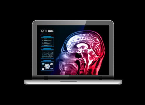 Notebook monitor with medical MRI and other real-time analyzes. Medicine of the future. Vector illustration on black