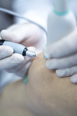 EPI needling physical therapy