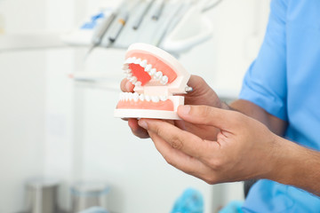 Professional dentist holding jaws model in clinic, closeup
