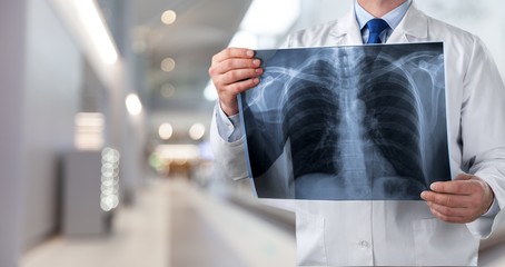 lung radiography concept. radiology doctor examining at chest x ray film of patient at hospital room.