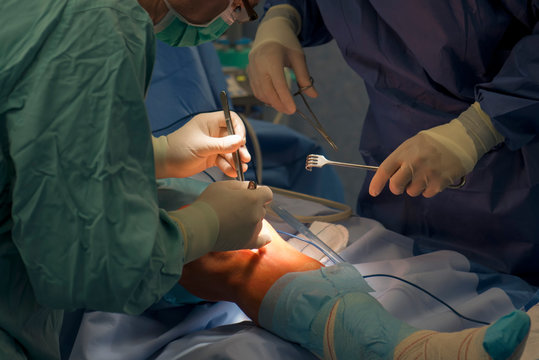 Knee Preservation Techniques: A Comprehensive Guide 8 360 F 292060047 JIW41hQK9GTRhCYedvo9oNIq5Q3vDJzM