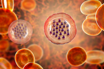 The malaria-infected red blood cells. 3D illustration showing malaria parasite Plasmodium falciparum in schizont stage inside red blood cells, the causative agent of tropical malaria - obrazy, fototapety, plakaty