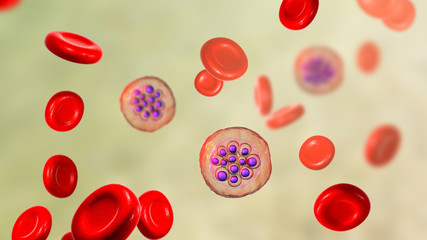 Red blood cells infected with malaria parasite Plasmodium vivax, schizont stage, 3D illustration