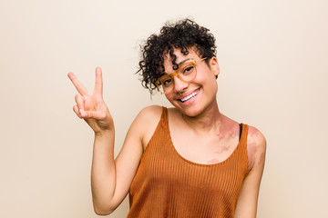 Young african american woman with skin birth mark joyful and carefree showing a peace symbol with fingers.