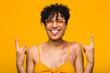 Young african american woman with skin birth mark showing rock gesture with fingers