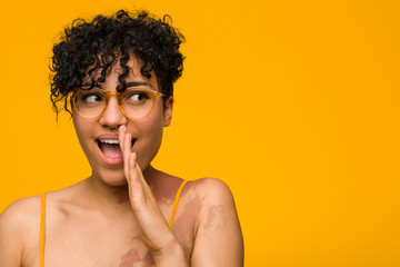 Young african american woman with skin birth mark is saying a secret hot braking news and looking aside - obrazy, fototapety, plakaty